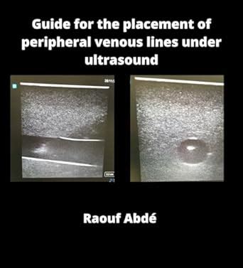 Guide for the placement of peripheral venous lines under ultrasound ...