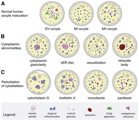 The ultrastructural nature of human oocytes’ cytoplasmic abnormalities and the role of ...