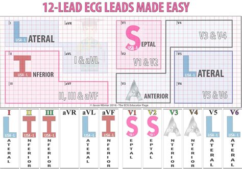 Printable 12 Lead Ekg Interpretation Cheat Sheet - Printable Calendars AT A GLANCE