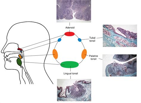 Reactive lymphoid aggregate – Dentowesome