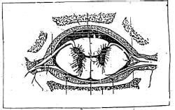 Structures Involved in Epidural Anesthesia - Animal Husbandry and ...