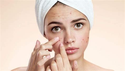 5 Homemade Face Packs To Get Rid of Acne Marks - lifeberrys.com