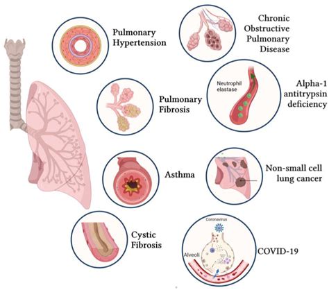 Respiratory System Diseases Medical Terminology Of The Respiratory
