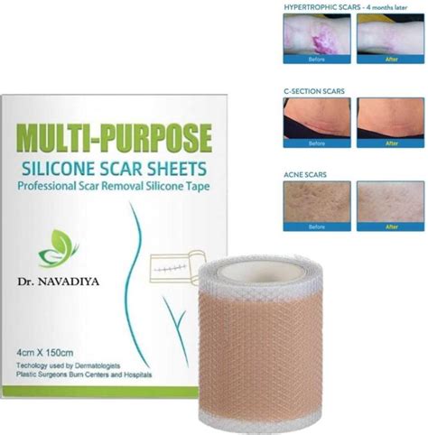 Dr. NAvadiya Scar Sheet , , Price in India - Buy Dr. NAvadiya Scar ...