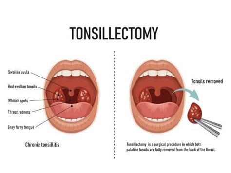 Top ENT hospital in Bangalore | Aster RV