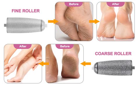 callus remover for feet dead skin remover pedicure tools Callus Remover ...
