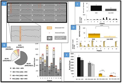 Phase-Amplitude Coupling Localizes Pathologic Brain with Aid of ...