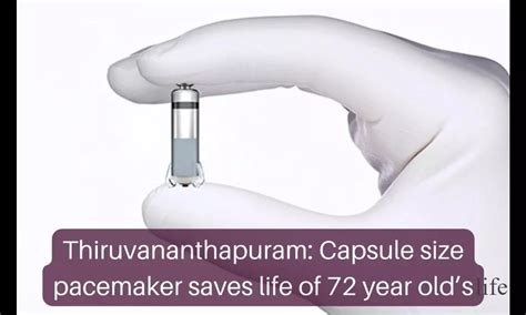 Capsule size pacemaker saves life of 72 year old's life