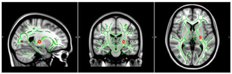 Behavioral Sciences | Special Issue : Polysubstance Use among ...
