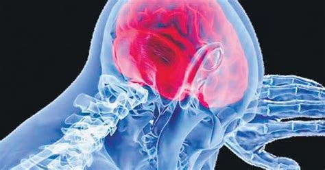 WHO Unveils First-Ever Clinical Guidelines To Bolster Global Battle ...