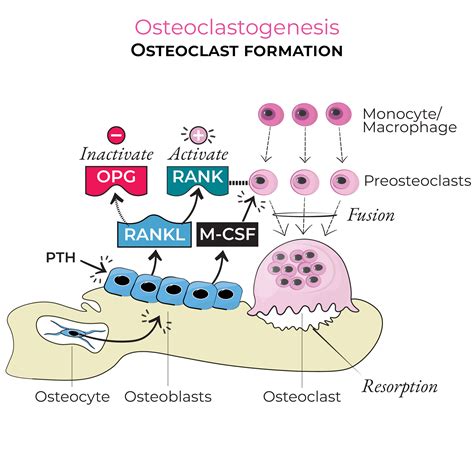 Gross Anatomy: Bone Resorption | ditki medical & biological sciences