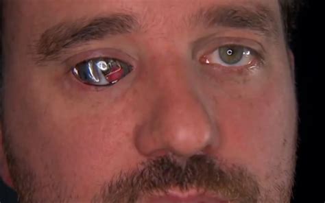 43岁失明男子，右眼装入摄像机，拍出30分钟纪录片_哔哩哔哩 (゜-゜)つロ 干杯~-bilibili