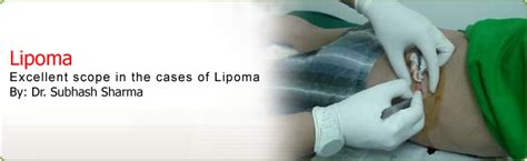 Lipoma Homeopathic Treatment | Homeopathy For Lipoma