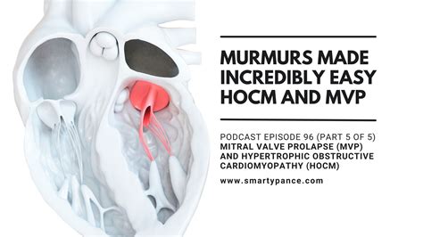 Obstructive Cardiomyopathy Murmur