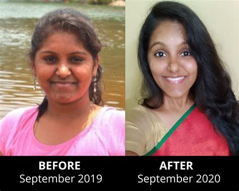 One Month Satvic lifestyle on, PCOD and Vitamin-D deficiency Gone ...