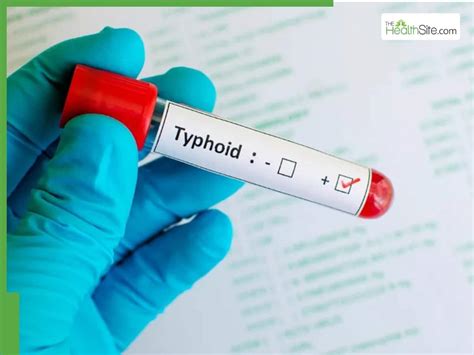 Drug-resistant typhoid in India: Why common antibiotics are failing and ...