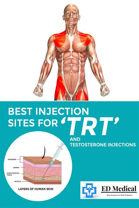 Testosterone Injection Sites 的图像结果