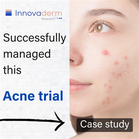 Indero Boosts Acne Study Enrollment and Overcomes Challenges