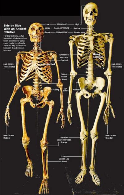 Image result for Skeleton Brain Exploding