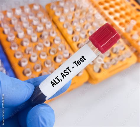 AST Blood Test 的图像结果