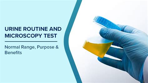 Urine Routine and Microscopy Test: Normal Range, Purpose & Benefits ...