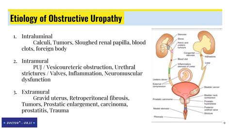 Obstructive Uropathy | PPTX
