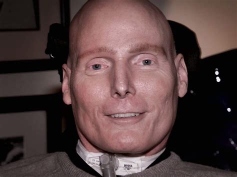 Famous Autopsy Photos - Surveys Hyatt