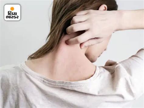 These spots may not even be visible to the naked eye, the skin may turn red