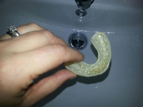 How To Clean Your Mouth Guard at James Mcmahan blog