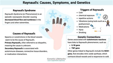 Nodding Syndrome Nodding Disease Causes Symptoms Diagnosis