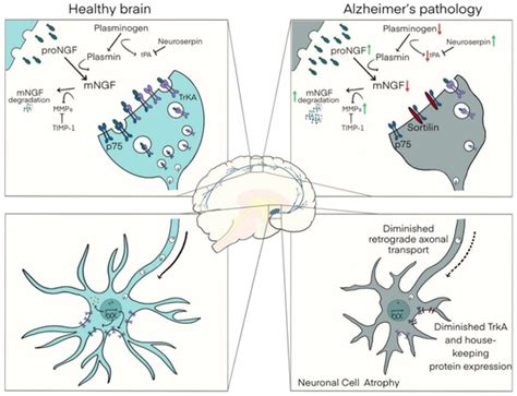 The Nerve Growth Factor Metabolic Pathway Dysregulation as Cause of ...