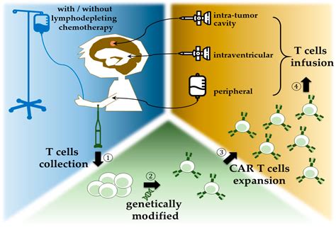 New Era of Immunotherapy in Pediatric Brain Tumors: Chimeric Antigen ...