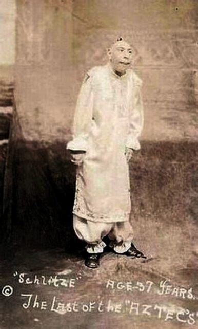 Schlitzie: The Tragic Story of The Famous Sideshow 'Pinhead'