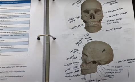 Basic Medical Coding Tutorial 的图像结果