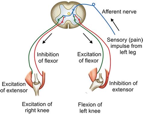Image result for Crossed Extensor Reflex Demonstration