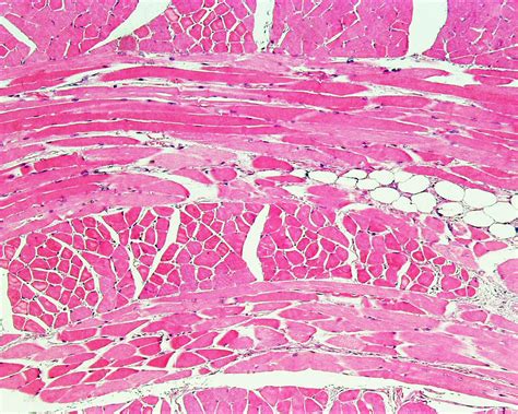 File:Skeletal muscle histology 001.jpg - Embryology