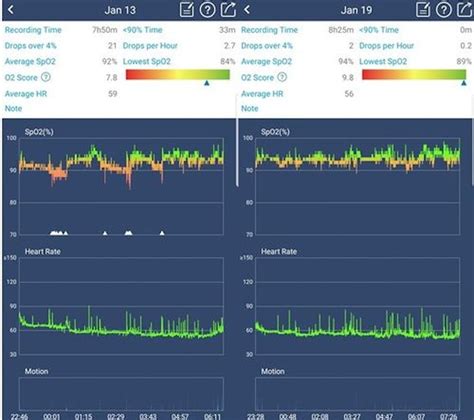 Image result for How to Tape O2 Monitor to Hand for Sleep Test