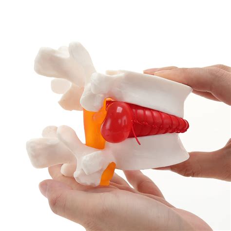 Buy Human Anatomical Lumbar Disc Herniation Model - Lumbar Spine Model ...