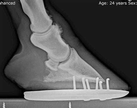 Ring Bone Disease In Horses at Abby Folingsby blog