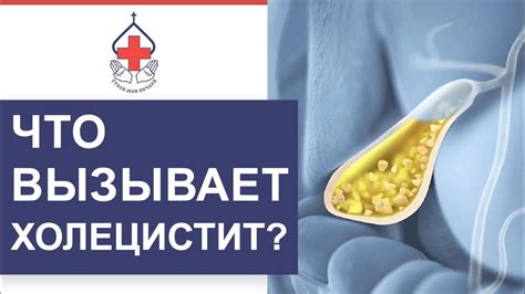 Холестаз — что это такое, виды и проявление заболевания ...