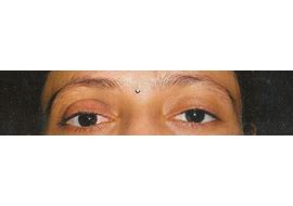 Eye Hospital in Ahmedabad | Eye Surgery | Ophthalmologist In Ahmedabad