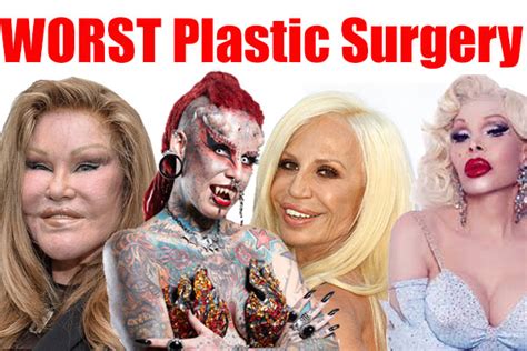 Plastic Surgery Disasters 的图像结果
