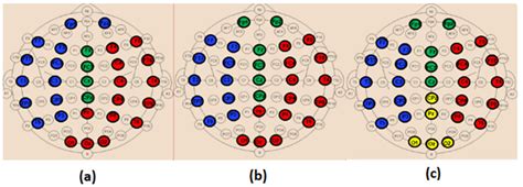Weighted Brain Network Analysis on Different Stages of Clinical ...