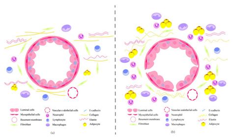 Recent Advances in the Aging Microenvironment of Breast Cancer