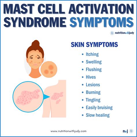 Good Ranchers Reviews: Low-Histamine Edition - Nutrition With Judy | Mast cell activation ...
