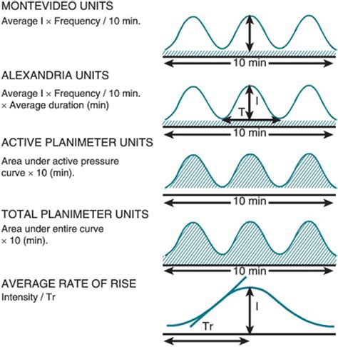 Assessment of uterine contractions in labor and delivery - American Journal of Obstetrics ...
