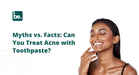 Myths vs. Facts: Can You Treat Acne with Toothpaste? – Belogical ...