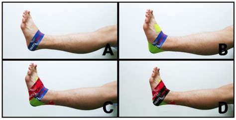 Immediate Effect of Balance Taping Using Kinesiology Tape on Dynamic ...