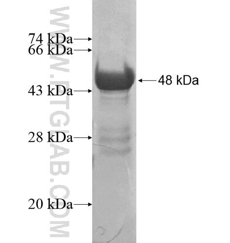 MYH11 Fusion Protein Ag13397 | Proteintech