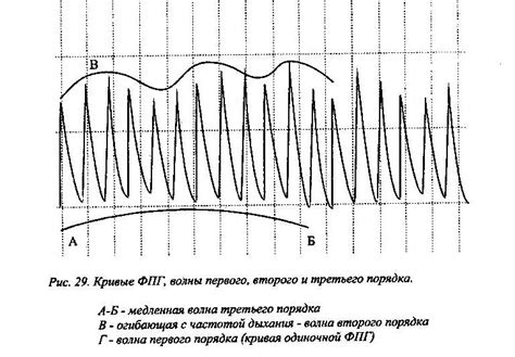 5. Фотоплетизмограмма (фпг).